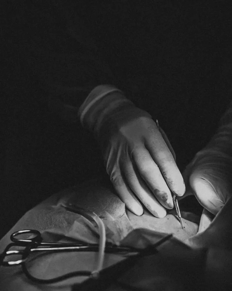 Mâinile unui chirurg în mănuși sterile, fotografie alb-negru