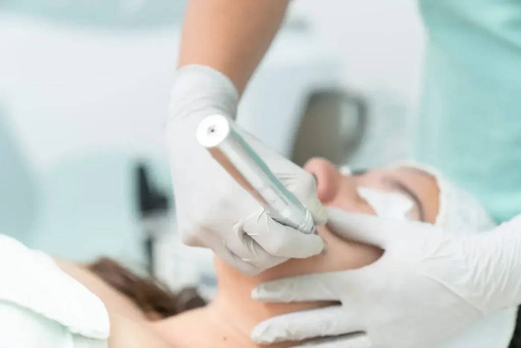 Tratament facial cu o piesă de mână laser, efectuat de un specialist